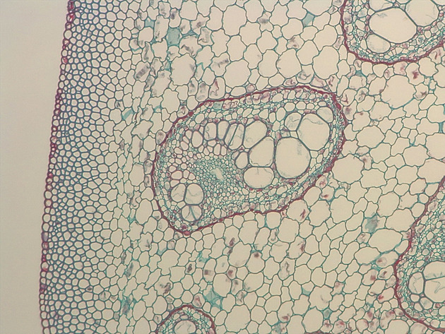 Fern Stem Slides - Fernstem 06 200X
